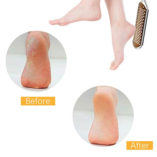 Педикир Нога Датотека Callus Смена - Големи Нога Rasp Колосална Нога Scrubber Професионални Нерѓосувачки Челик Callus Датотека за